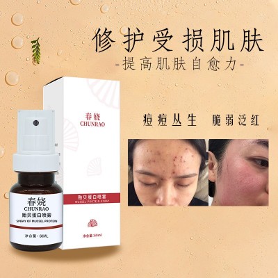 美容院贻贝粘蛋白修护喷雾补水保湿滋润修护敏感红脸爽肤水湿敷水图3