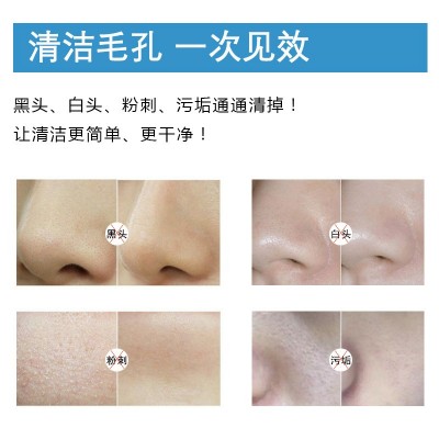 美容院毛囊清洁霜深度去黑头粉刺闭口角质清洁毛孔面部按摩膏批发图3