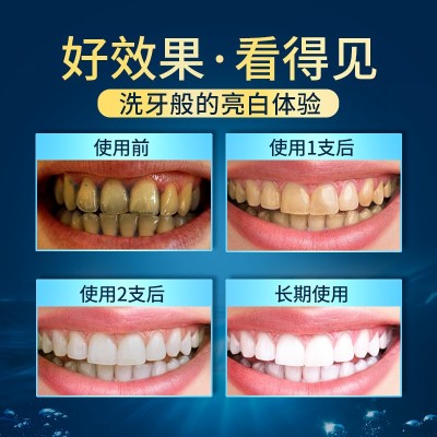 厂家批发百力巨人小苏打牙膏清新口气去牙渍成人儿童通用修护牙膏图4