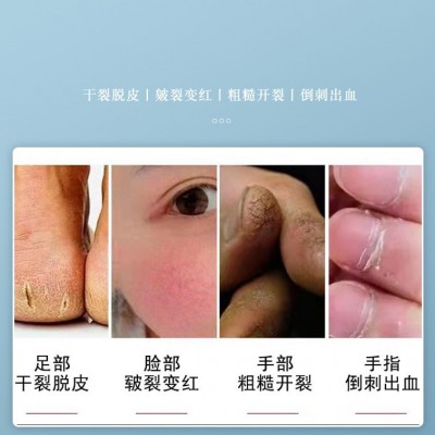 七草立清 冬季防护套装护肤滋润礼品套装批发图3